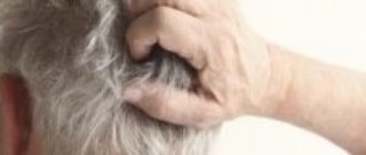 Чешется кожа головы и увеличены лимфоузлы