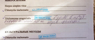 В ЖК обнаружили вирус хламидиоз, возможно, что никто не изменял?