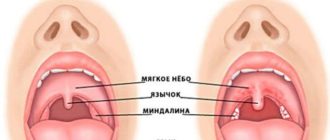 Дерет стенку горла