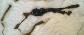 Месячные у девочек 12 лет черного цвета