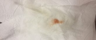 Выделения при беременности 6-7 недель