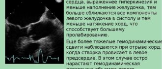 Что значит гиперкинез сердца?