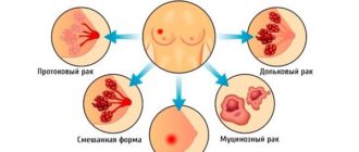 Выделения из груди во время беременности