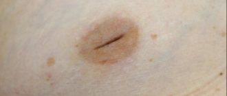 Внутренний сосок