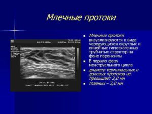 Чем опасно расширение протоков мж