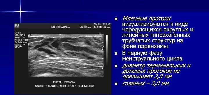 Чем опасно расширение протоков мж