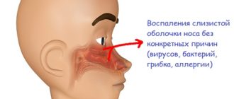 Вазомоторный ринит без насморка
