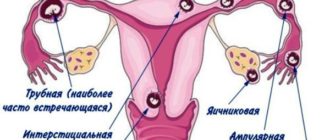 Возможность беременности, если идут месячные