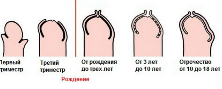 Во сколько должна быть открыта головка