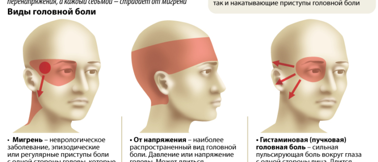 Давит левый глаз. Головная боль. Головная юоль в затылке. Боль в висках головы. Виды головной боли.