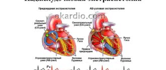 Наджелудочковая экстрасистолия у ребенка