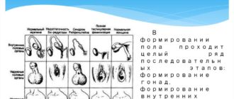 Нарушение формирования пола