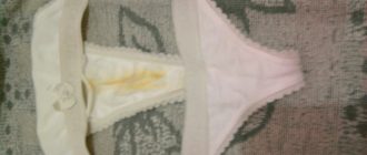 Воняет прокладка на трусах