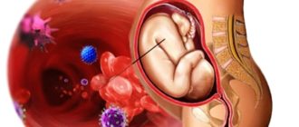 Внутриутробные инфекции