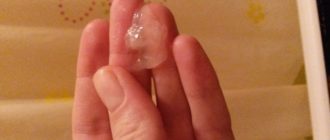 Выделения при беременности 24 недели