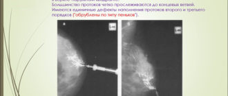 Внутрипротоковое образование