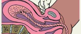 Воздух во влагалище