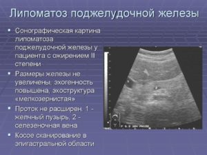 Уз-признаки диффузных изменений печени по типу липоматоза