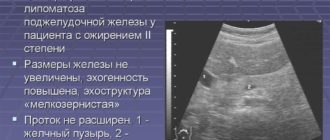 Уз-признаки диффузных изменений печени по типу липоматоза