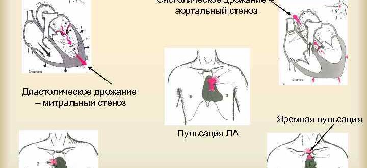 Дрожь в сердце