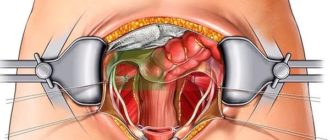 Восстановление организма после удаления матки