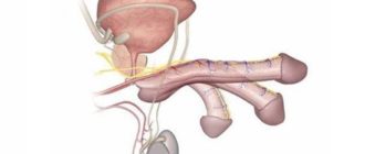 Член сильно направлен вниз при эрекции