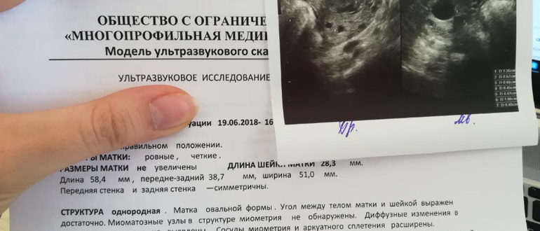В какой срок после овуляции можно делать узи