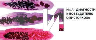 В крови антитела IgG Opisthorchis felineus