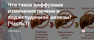 Диффузные изменения в печени и поджелудочной