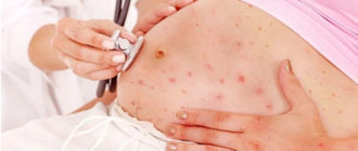 Ветрянка, месячные