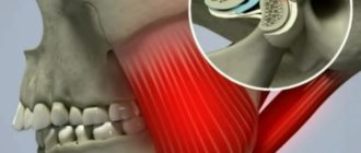 Давит челюсть с двух сторон