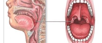 Воспаление лимфоидной ткани
