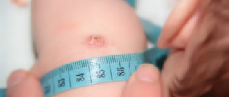 Делать ли прививку БЦЖ