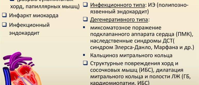 Что значит подклапанная ТР?
