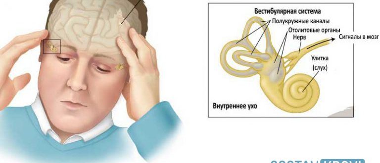 Нарушение вестибулярного аппарата